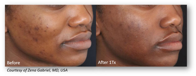 Skin-Blemishes-1