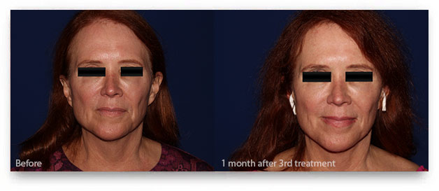 Skin-Blemishes-ba4